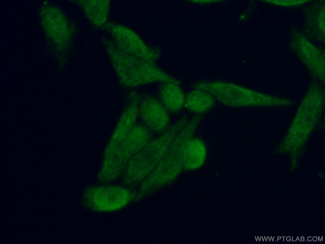 IQCD Antibody in Immunocytochemistry (ICC/IF)