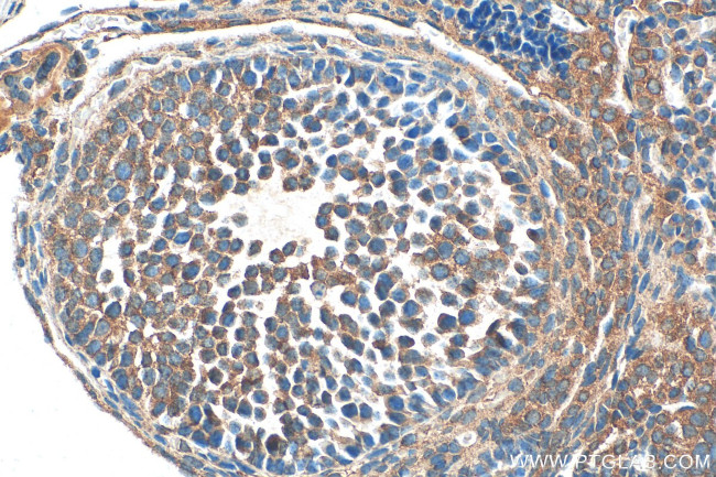 KIAA1109 Antibody in Immunohistochemistry (Paraffin) (IHC (P))
