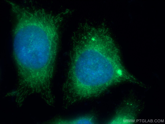 C5orf33 Antibody in Immunocytochemistry (ICC/IF)