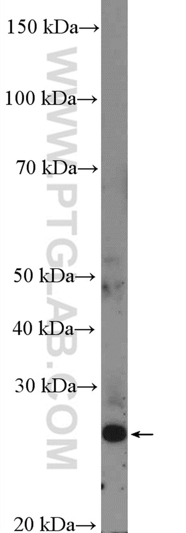 FLJ14213 Antibody in Western Blot (WB)