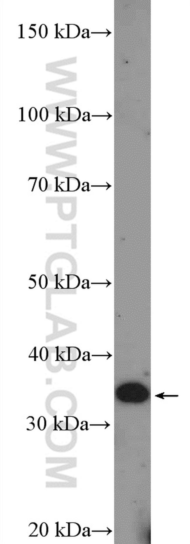 DCUN1D3 Antibody in Western Blot (WB)