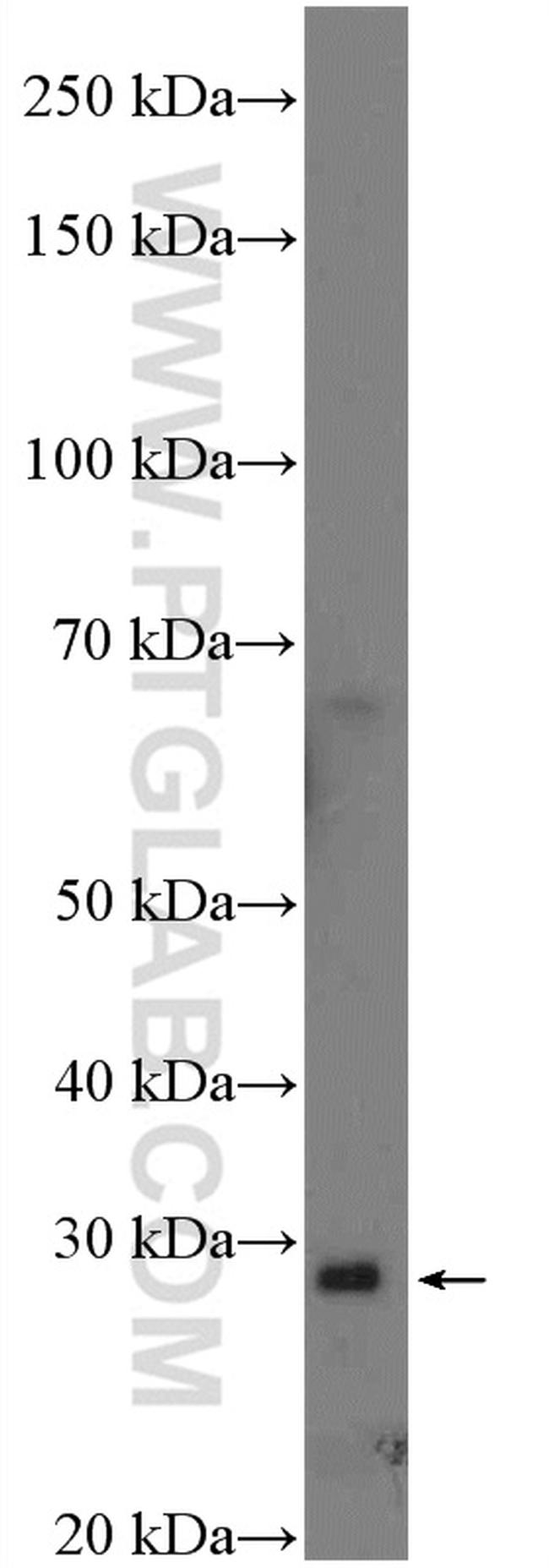 C20orf7 Antibody in Western Blot (WB)