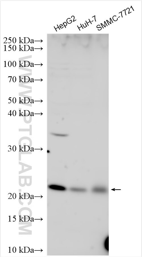 COMMD7 Antibody in Western Blot (WB)