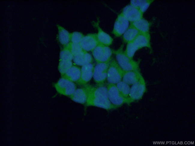 RNF14 Antibody in Immunocytochemistry (ICC/IF)
