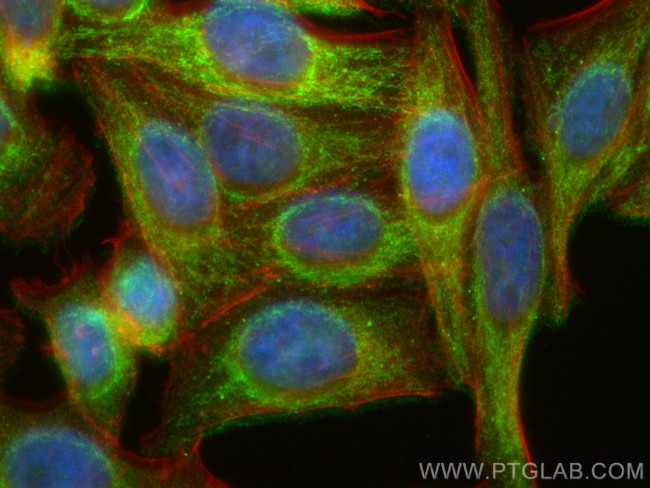 SLC25A36 Antibody in Immunocytochemistry (ICC/IF)