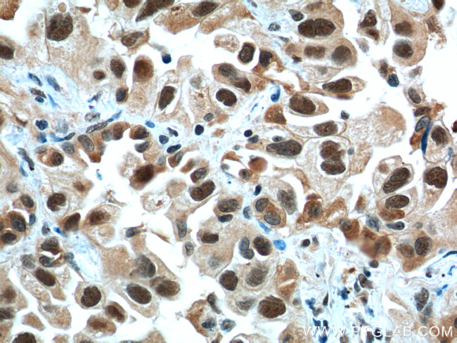 CCDC59 Antibody in Immunohistochemistry (Paraffin) (IHC (P))
