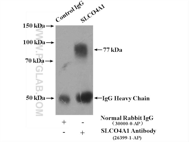 SLCO4A1 Antibody in Immunoprecipitation (IP)