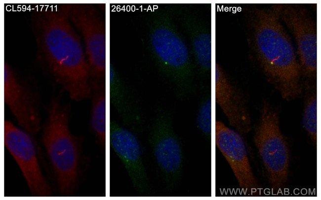 LRRC6 Antibody in Immunocytochemistry (ICC/IF)