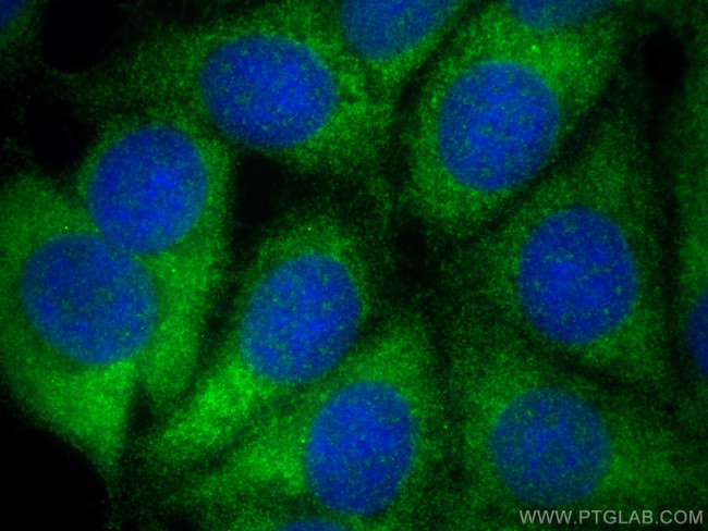WISP3 Antibody in Immunocytochemistry (ICC/IF)