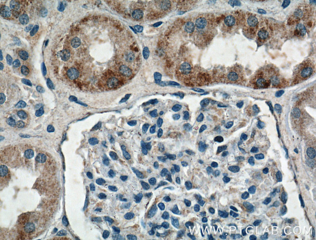 HTR2B Antibody in Immunohistochemistry (Paraffin) (IHC (P))