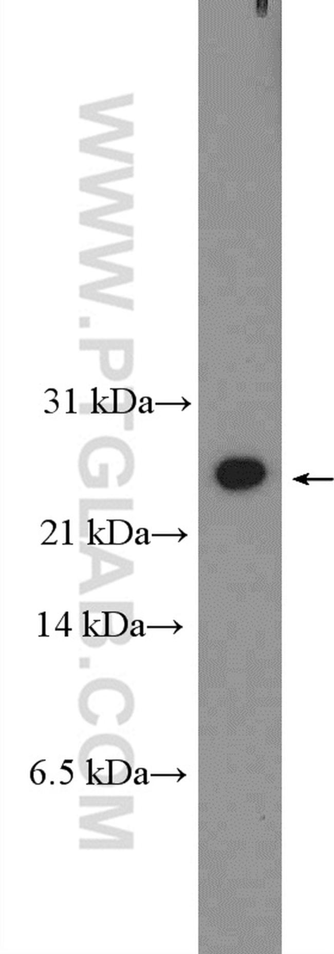 C16orf63 Antibody in Western Blot (WB)