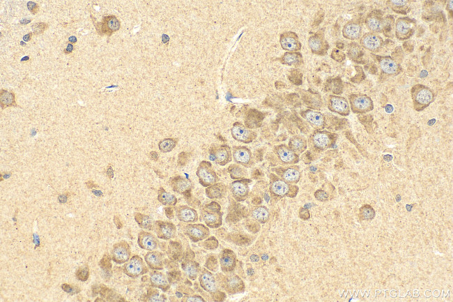 SLC29A4 Antibody in Immunohistochemistry (Paraffin) (IHC (P))
