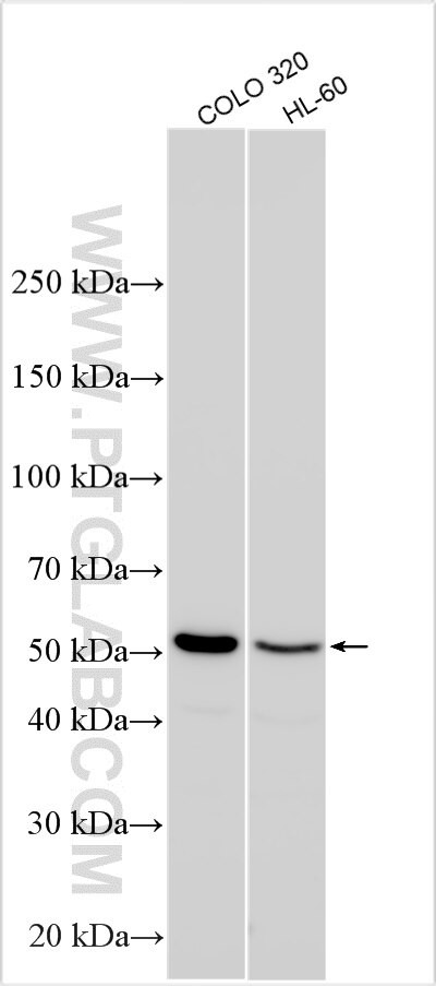 KCNH1 Antibody in Western Blot (WB)