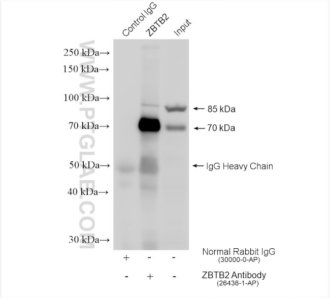 ZBTB2 Antibody in Immunoprecipitation (IP)