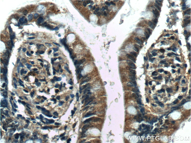 5HT2A Receptor Antibody in Immunohistochemistry (Paraffin) (IHC (P))