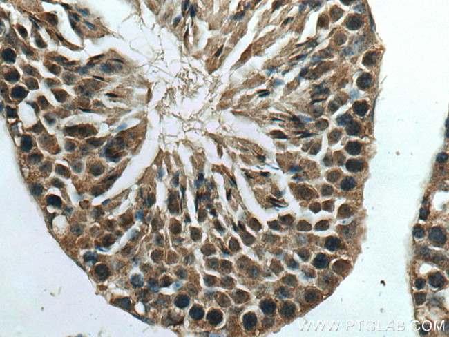 TMEM97 Antibody in Immunohistochemistry (Paraffin) (IHC (P))
