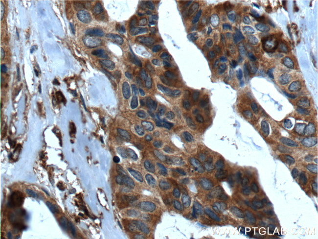 SRMS Antibody in Immunohistochemistry (Paraffin) (IHC (P))