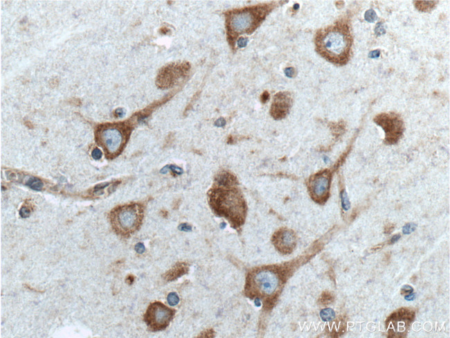 NME7 Antibody in Immunohistochemistry (Paraffin) (IHC (P))