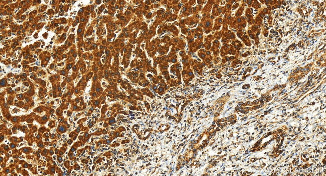 TMEM160 Antibody in Immunohistochemistry (Paraffin) (IHC (P))