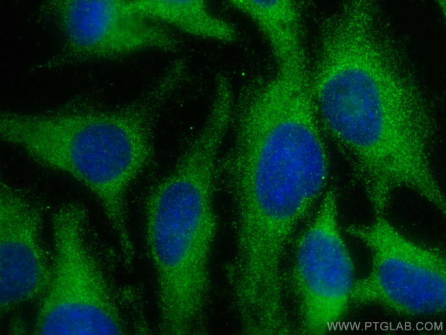 MOS Antibody in Immunocytochemistry (ICC/IF)