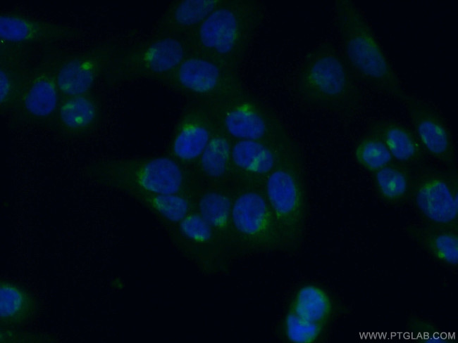 GMAP-210 Antibody in Immunocytochemistry (ICC/IF)