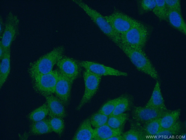 Ch-TOG Antibody in Immunocytochemistry (ICC/IF)