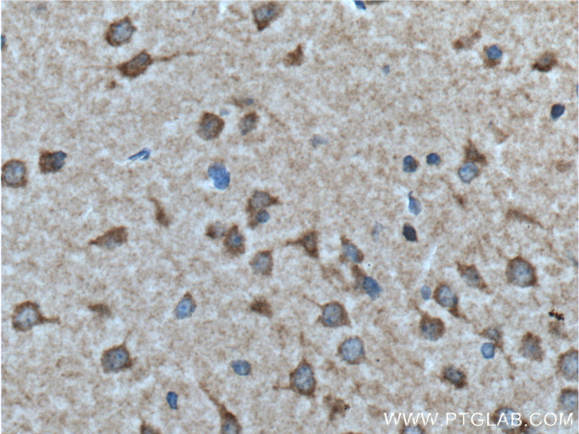 GALR2 Antibody in Immunohistochemistry (Paraffin) (IHC (P))
