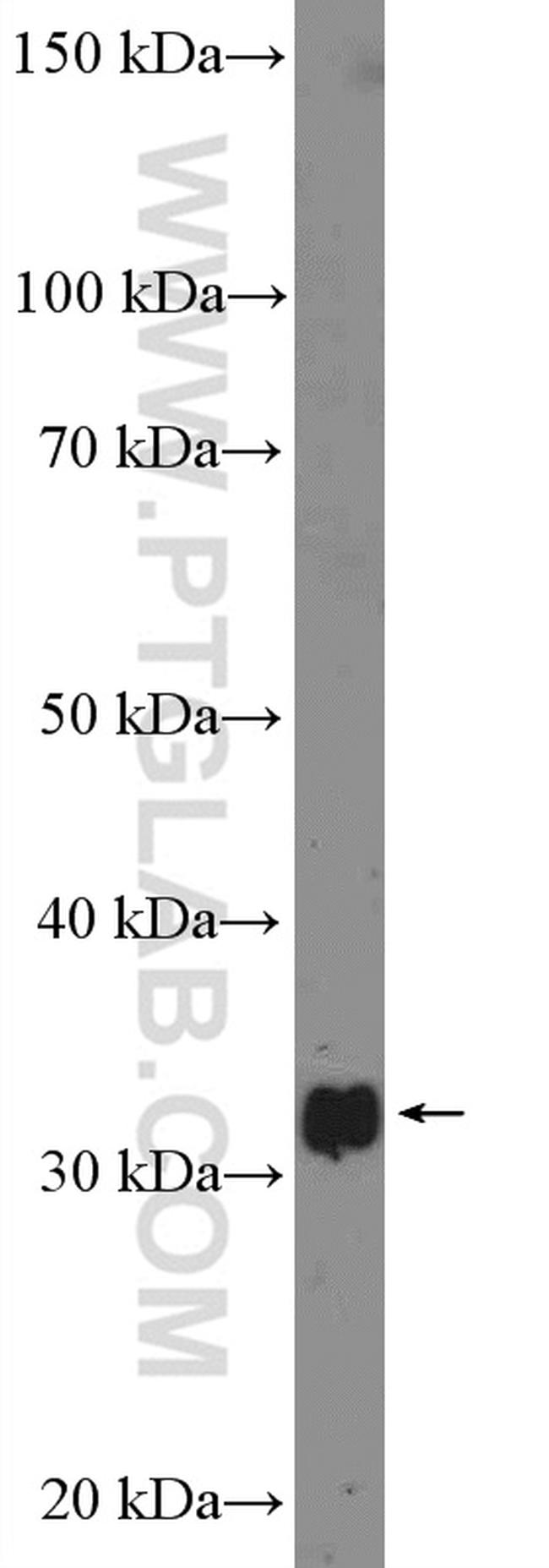 CCNC Antibody in Western Blot (WB)