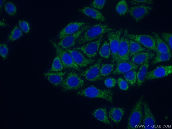 GLE1 Antibody in Immunocytochemistry (ICC/IF)
