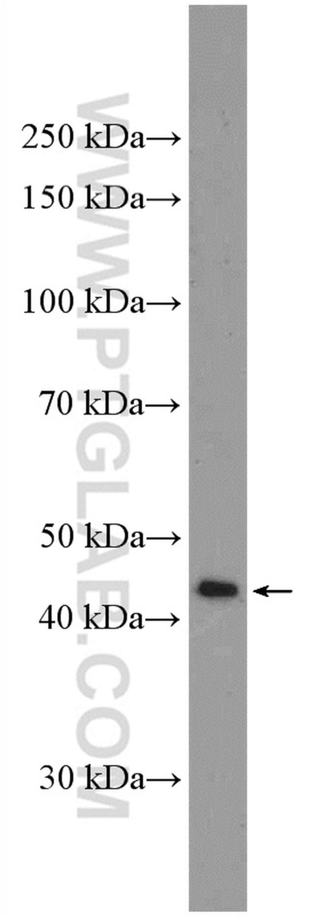 Nesprin 4 Antibody in Western Blot (WB)