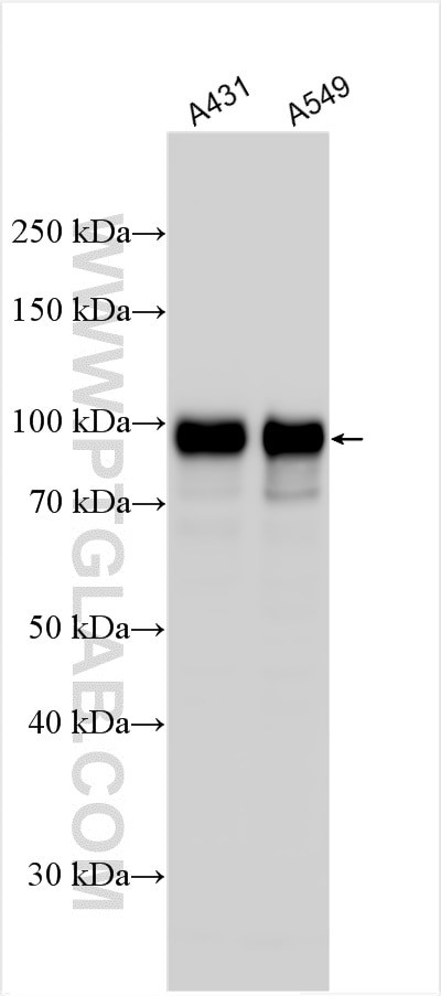 ERF Antibody in Western Blot (WB)
