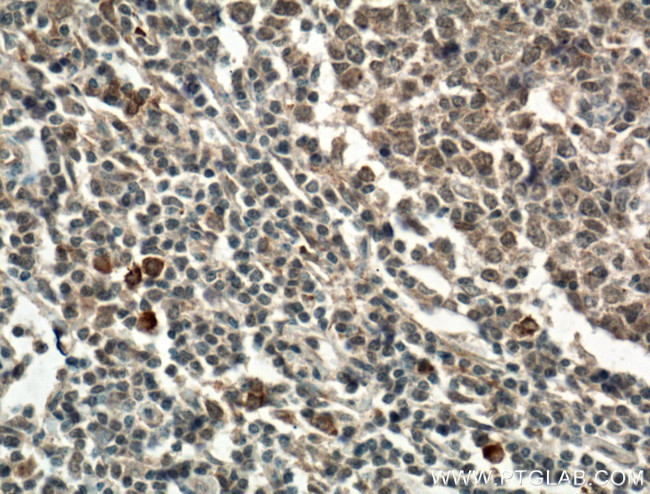 L-selectin Antibody in Immunohistochemistry (Paraffin) (IHC (P))