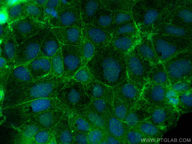 Plakophilin 2 Antibody in Immunocytochemistry (ICC/IF)
