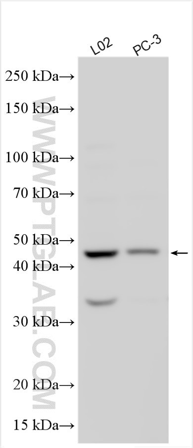 FAM161B Antibody in Western Blot (WB)