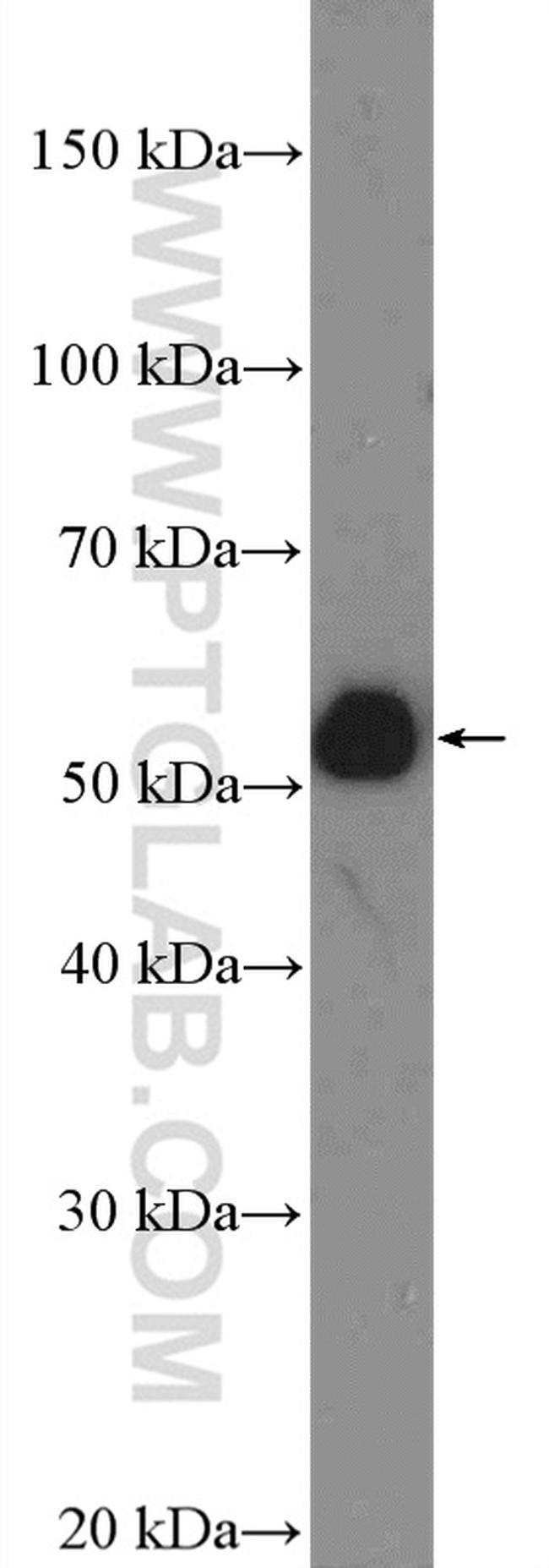 HOXA10 Antibody in Western Blot (WB)