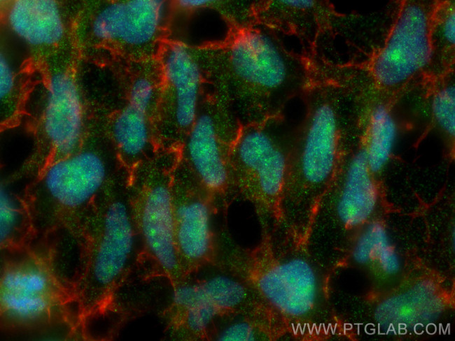 AMBN Antibody in Immunocytochemistry (ICC/IF)