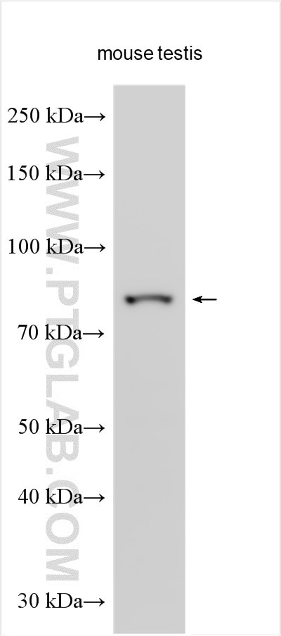 Anosmin-1 Antibody in Western Blot (WB)