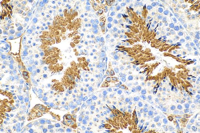 FAM181A Antibody in Immunohistochemistry (Paraffin) (IHC (P))