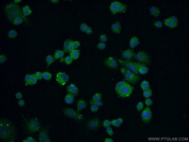 C13orf1 Antibody in Immunocytochemistry (ICC/IF)