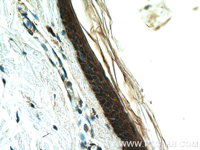 LCE2B Antibody in Immunohistochemistry (Paraffin) (IHC (P))