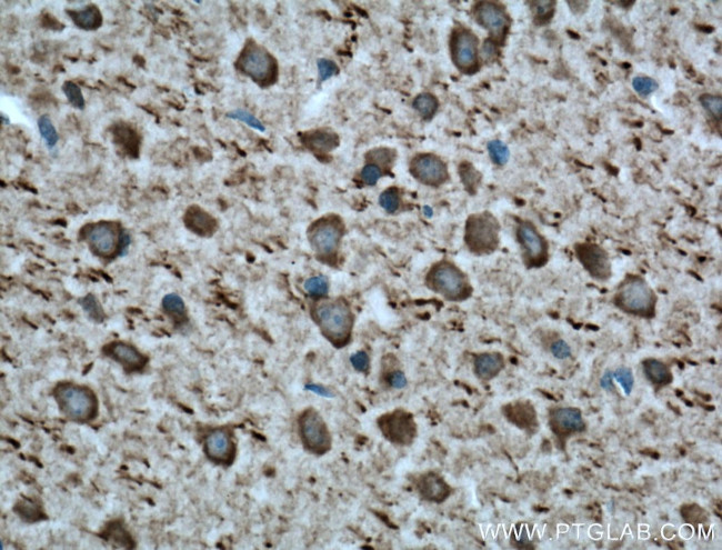 Parvalbumin Antibody in Immunohistochemistry (Paraffin) (IHC (P))
