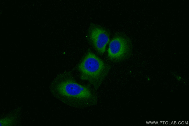 SLC39A14/ZIP-14 Antibody in Immunocytochemistry (ICC/IF)