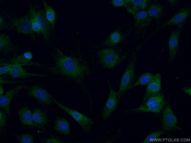 CPT2 Antibody in Immunocytochemistry (ICC/IF)