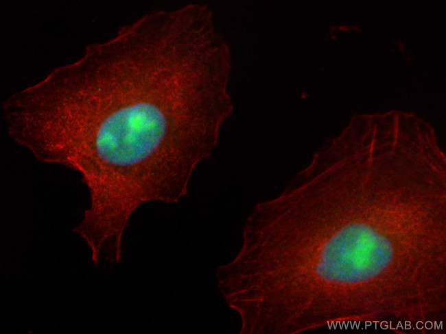 ECT2 Antibody in Immunocytochemistry (ICC/IF)