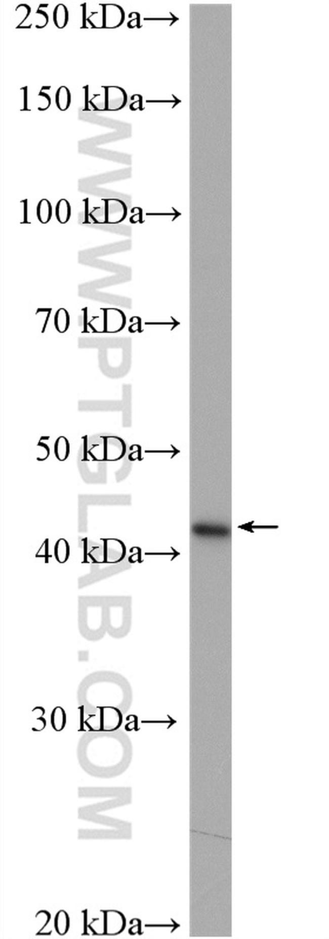 SERPINB3 Antibody in Western Blot (WB)