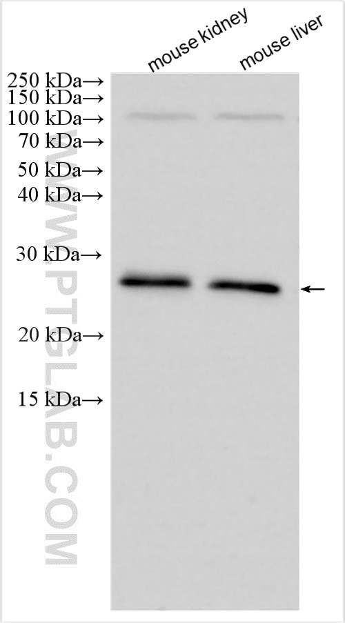 CMTM4 Antibody in Western Blot (WB)