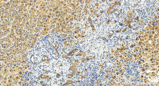 LIMCH1 Antibody in Immunohistochemistry (Paraffin) (IHC (P))