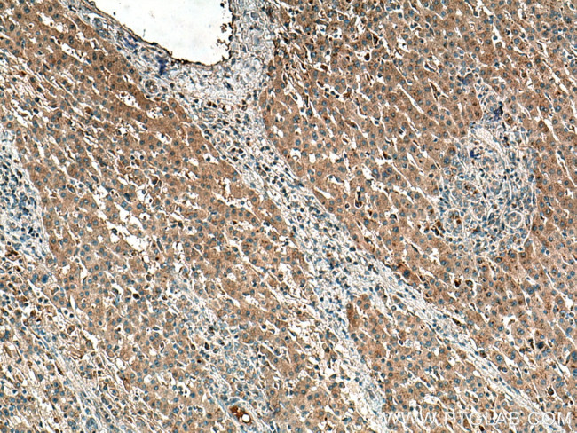 ATG101 Antibody in Immunohistochemistry (Paraffin) (IHC (P))