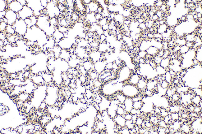 ABCA1 Antibody in Immunohistochemistry (Paraffin) (IHC (P))