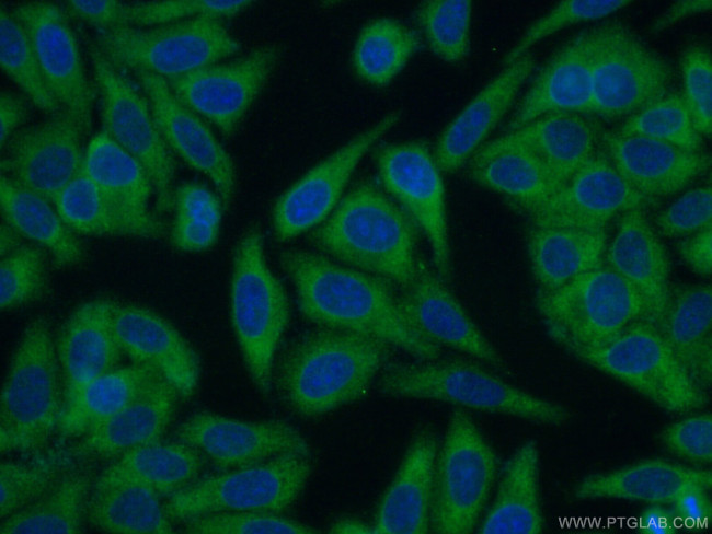 EHHADH Antibody in Immunocytochemistry (ICC/IF)